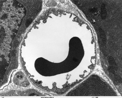 Transmission electron microscope image of a capillary with a red blood cell within the pancreas